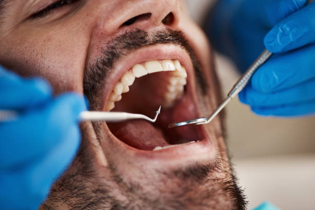 Best Emergency Treatment for Toothache in Bruceville Eddy, TX