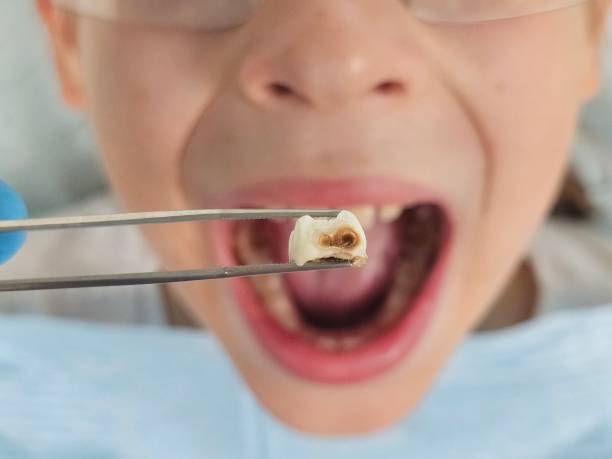 Best After-Hours Emergency Dentist in Bruceville Eddy, TX